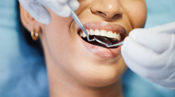 Best Chipped Tooth Repair Near Me  in Merlin, OR